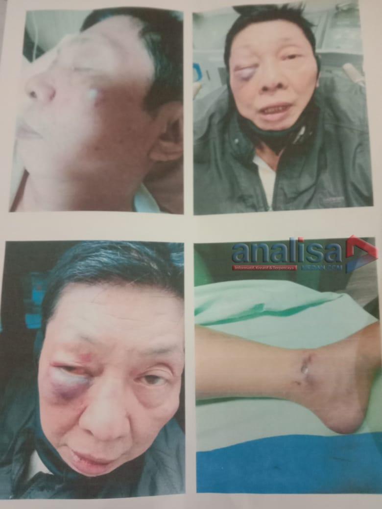 Pria Renta Dianiaya hingga Kritis, Pelaku Belum Ditangkap