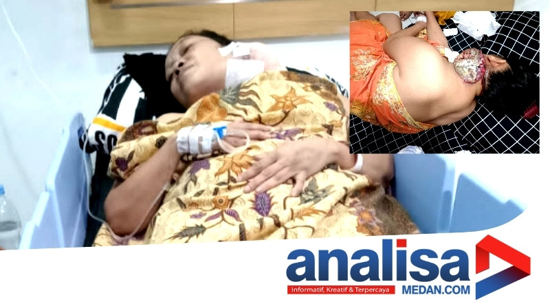 Akhirnya Penderita 'Kanker Leher' Dirawat RSUP Adam Malik Setelah Disuruh 'Pulang'